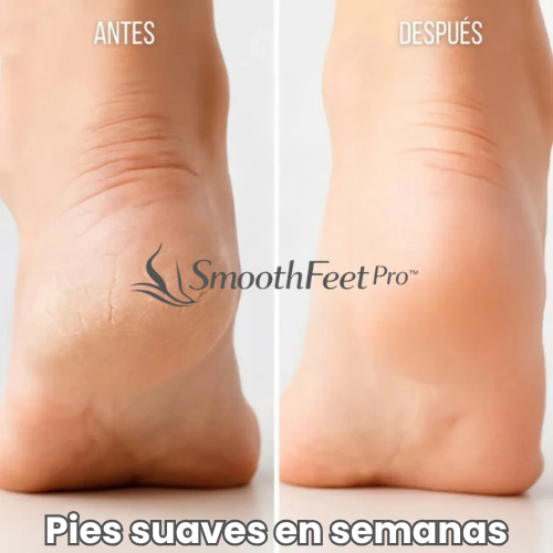 SmoothFeet Pro™ – Pies suaves y lisos desde la primera aplicación