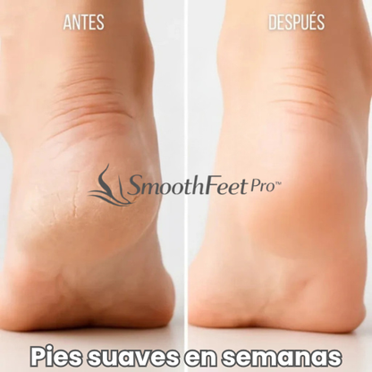 SmoothFeet Pro™ – Pies suaves y lisos desde la primera aplicación